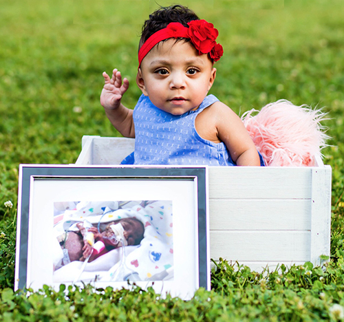 Baby sitting behind a photo of her as a newborn with lots of medical equipment attached to her