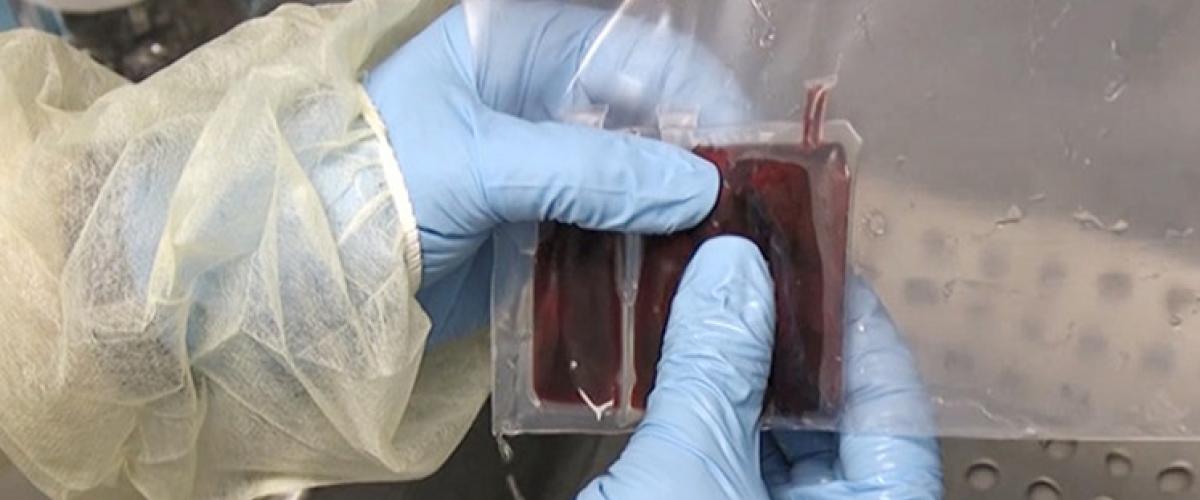 Gloved hands holding a packet of cord blood