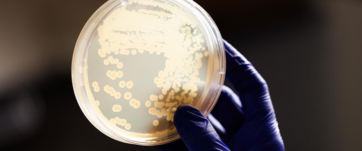 sample from duke peds ID lab